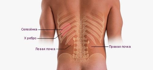 Боль в левом подреберье - причины, симптомы, диагностика и лечение боли под ребрами в левом боку